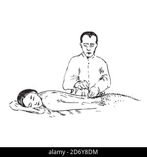 Doktor legen Akupunkturnadeln`s den Rücken der Frau, handgezeichnetes Doodle, Skizze im Pop-Art-Stil, schwarz-weiße medizinische Illustration Stockfoto